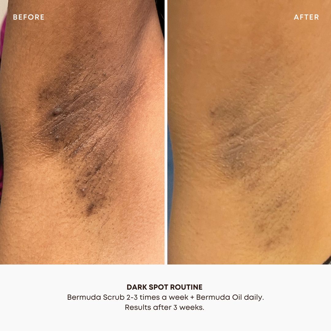 Bermuda Dark Spot 2 Step Routine